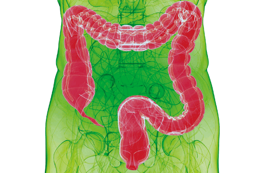 Grafik menschlicher Torso mit rot eingefärbtem Darm